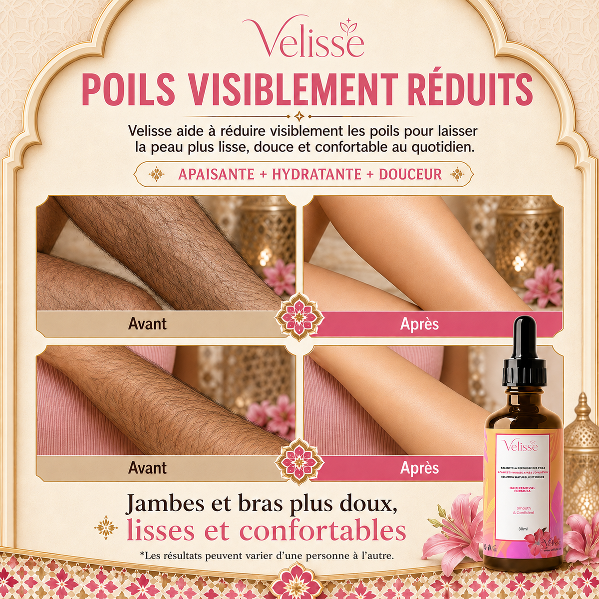 Velisse™ | Huile Dépilatoire Douce Tout-en-Un