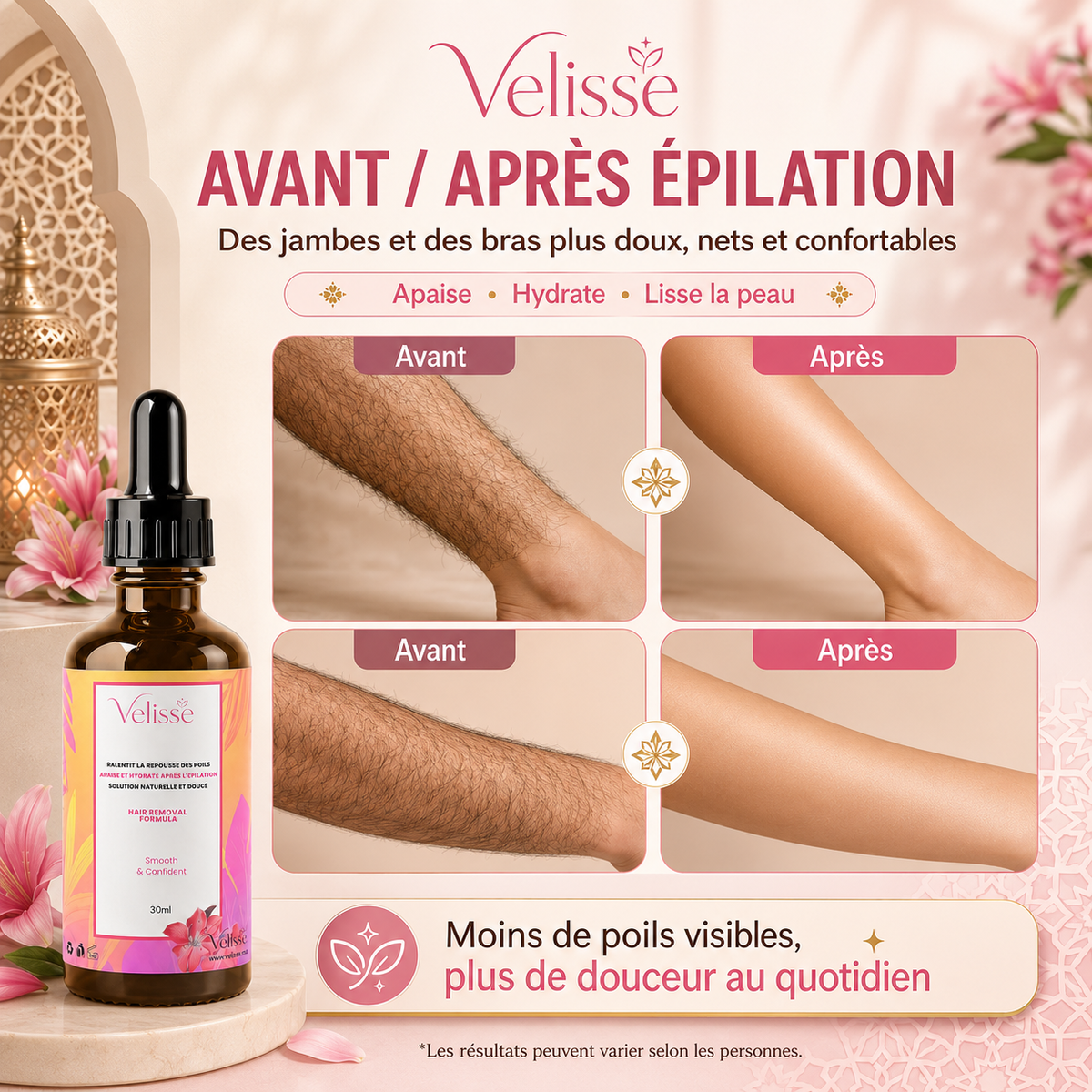 Velisse™ | Huile Dépilatoire Douce Tout-en-Un