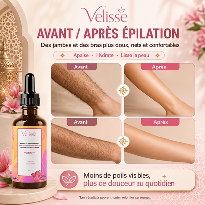 Velisse™ | Huile Dépilatoire Douce Tout-en-Un